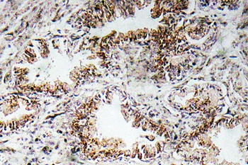 AChRα1 rabbit pAb Antibody