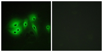 A Cyclase VIII rabbit pAb Antibody