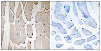 MARCH3 rabbit pAb Antibody