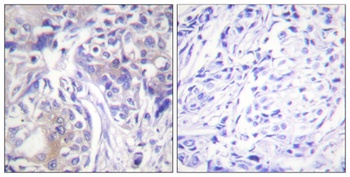ADD1 rabbit pAb Antibody