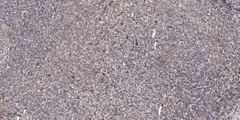 CPXM2 rabbit pAb Antibody