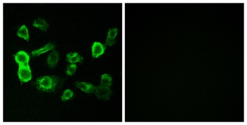 Olfactory receptor 5P2 rabbit pAb Antibody