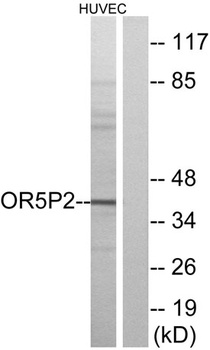 Olfactory receptor 5P2 rabbit pAb Antibody