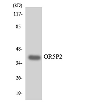 Olfactory receptor 5P2 rabbit pAb Antibody