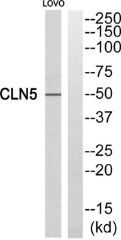 CLN5 rabbit pAb Antibody