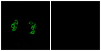 Casein Kinase I α1/1L rabbit pAb Antibody
