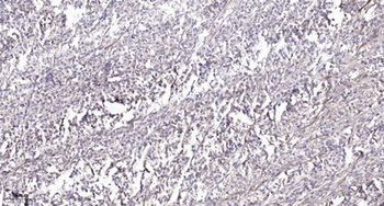 Relaxin Receptor 2 rabbit pAb Antibody
