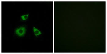 MRP-L52 rabbit pAb Antibody