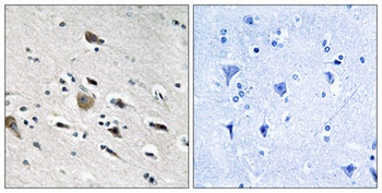 MRP-L52 rabbit pAb Antibody