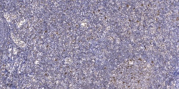 JDP2 (phospho Thr148) rabbit pAb Antibody