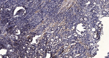 JDP2 rabbit pAb Antibody