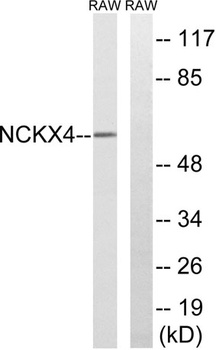 NCKX4 rabbit pAb Antibody