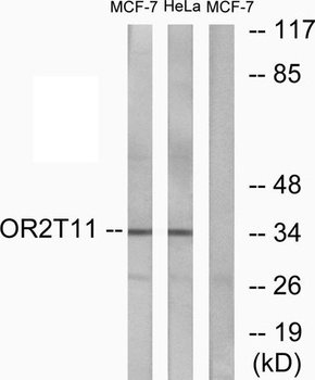 Olfactory receptor 2T11 rabbit pAb Antibody