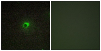 ACTR-IC rabbit pAb Antibody