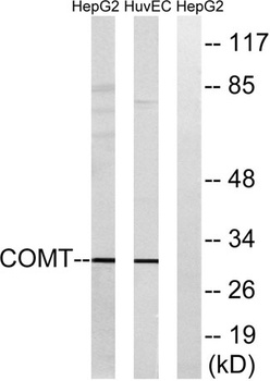 COMT rabbit pAb Antibody