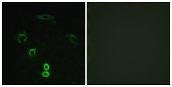 Glycerate Kinase rabbit pAb Antibody