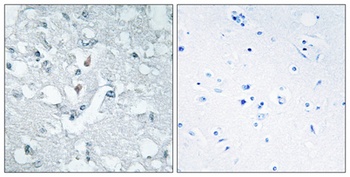 Glycerate Kinase rabbit pAb Antibody