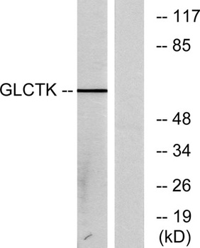 Glycerate Kinase rabbit pAb Antibody