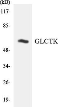 Glycerate Kinase rabbit pAb Antibody