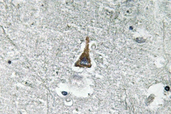 ADM rabbit pAb Antibody