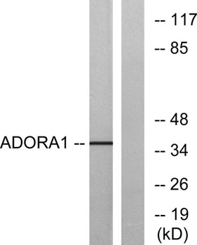 Adenosine A1-R rabbit pAb Antibody