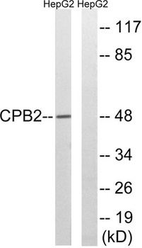 TAFI rabbit pAb Antibody