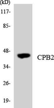 TAFI rabbit pAb Antibody