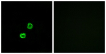 GCNT7 rabbit pAb Antibody