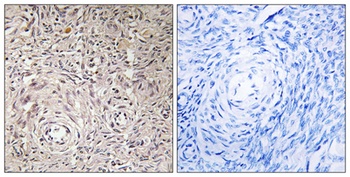 GCNT7 rabbit pAb Antibody