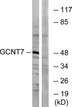 GCNT7 rabbit pAb Antibody
