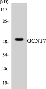 GCNT7 rabbit pAb Antibody
