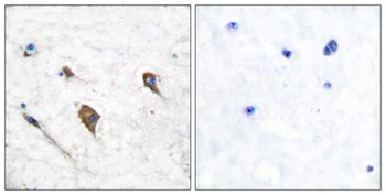 IL-3Rβ (phospho Tyr593) rabbit pAb