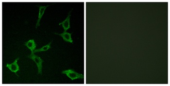 Olfactory receptor 2AG1/2 rabbit pAb Antibody