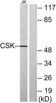 Csk rabbit pAb Antibody