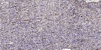 Casein Kinase Iα (phospho Thr321) rabbit pAb