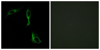 AR-α1D rabbit pAb Antibody