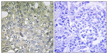 AR-α1D rabbit pAb Antibody