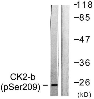 Casein Kinase IIβ (phospho Ser209) rabbit pAb