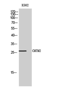 CMTM2 rabbit pAb Antibody