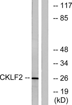 CMTM2 rabbit pAb Antibody