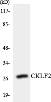 CMTM2 rabbit pAb Antibody