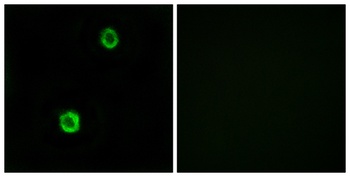 Cystatin SN rabbit pAb Antibody