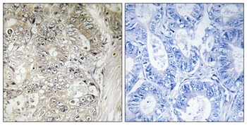 Cystatin SN rabbit pAb Antibody