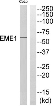 Eme1 rabbit pAb Antibody
