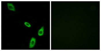AR-α1B rabbit pAb Antibody