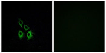 AR-α1A rabbit pAb Antibody