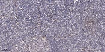 CtBP2 rabbit pAb Antibody