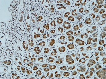 Catenin-α1 rabbit pAb
