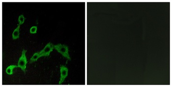 AR-α2A rabbit pAb Antibody