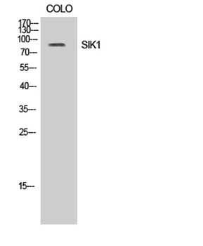 SIK1 rabbit pAb Antibody